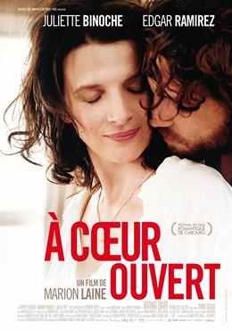 À Coeur Ouvert – Kollarımda Kal