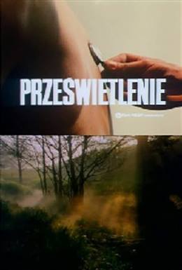Przeswietlenie – Röntgen